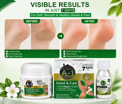 A-1 Hand & Foot Crack Repair Cream | 2-in-1 Formula for Soft & Smooth Skin