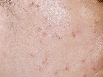 OIL CONTROL
