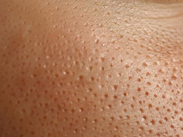 OPEN PORES