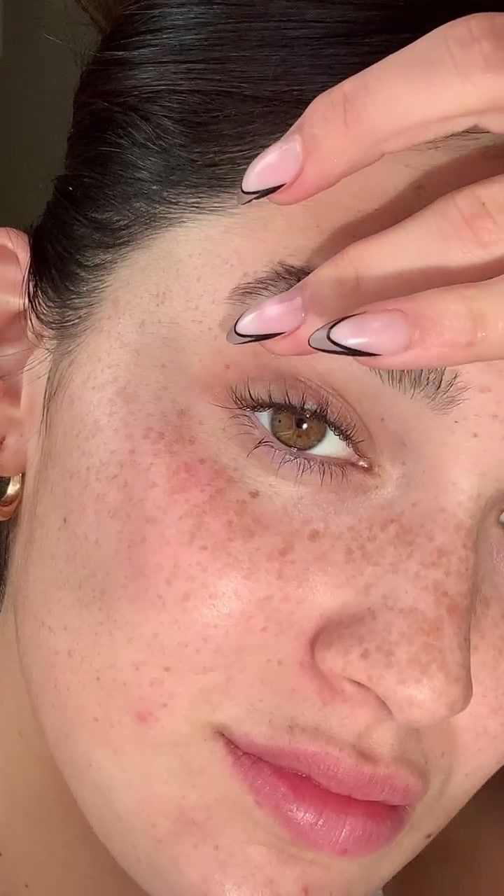 FRECKLES